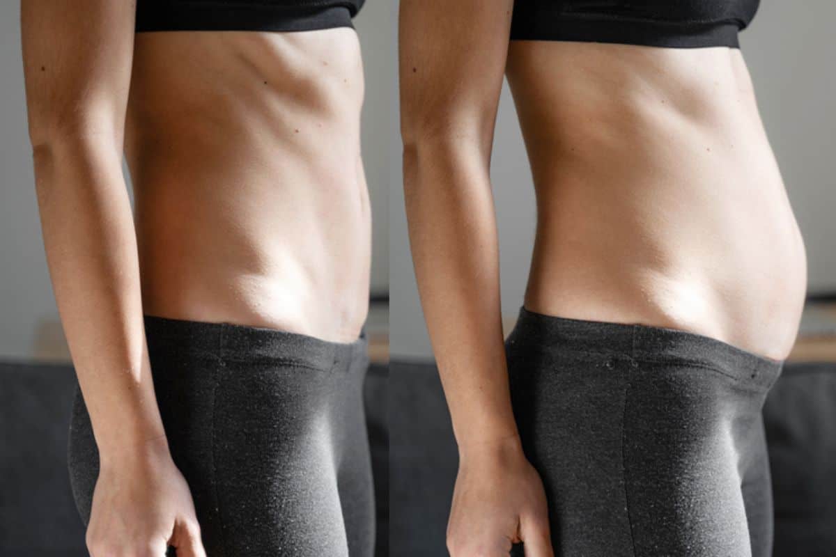 How long does diastasis recti take to improve West Kensington?