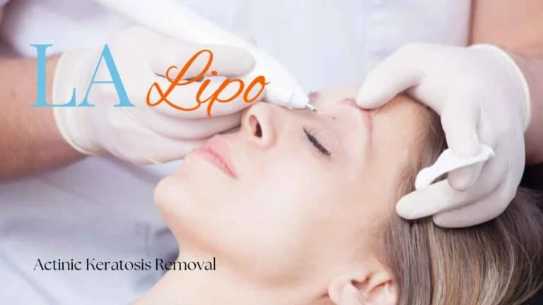 Woman receiving Actinic Keratosis Removal Treatment West Kensington