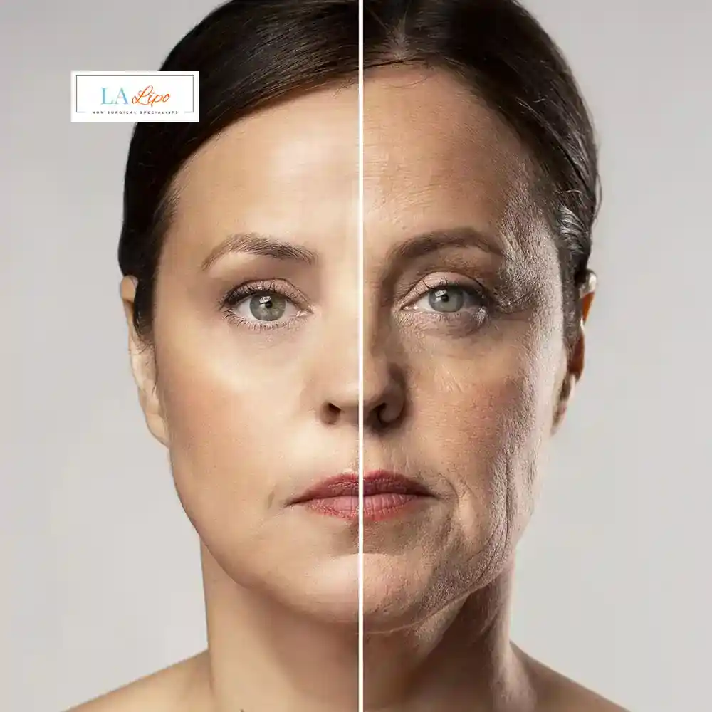 How Can You Tell If Non-Surgical Skin Tightening Is Right for You West Kensington?